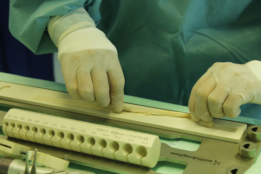 Realiza ISSSTEP primer injerto de ligamento cruzado del 2020 mediante cirugía artroscópica.