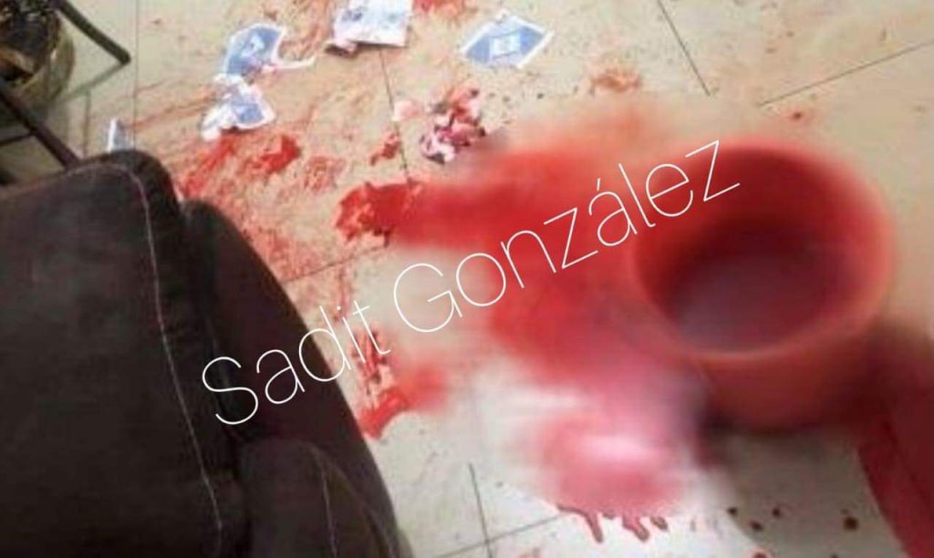 Balean casa de regidora en Huixcolotla: su estado de salud se reporta grave.