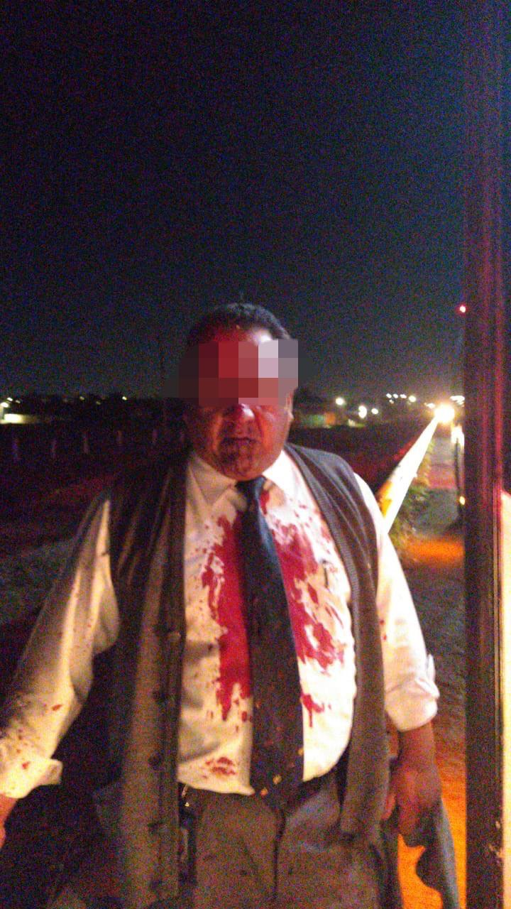 Chofer de un autobús línea AU resultó lesionado luego de que hombres arrojaron piedras a su unidad para intentar asaltarlo
