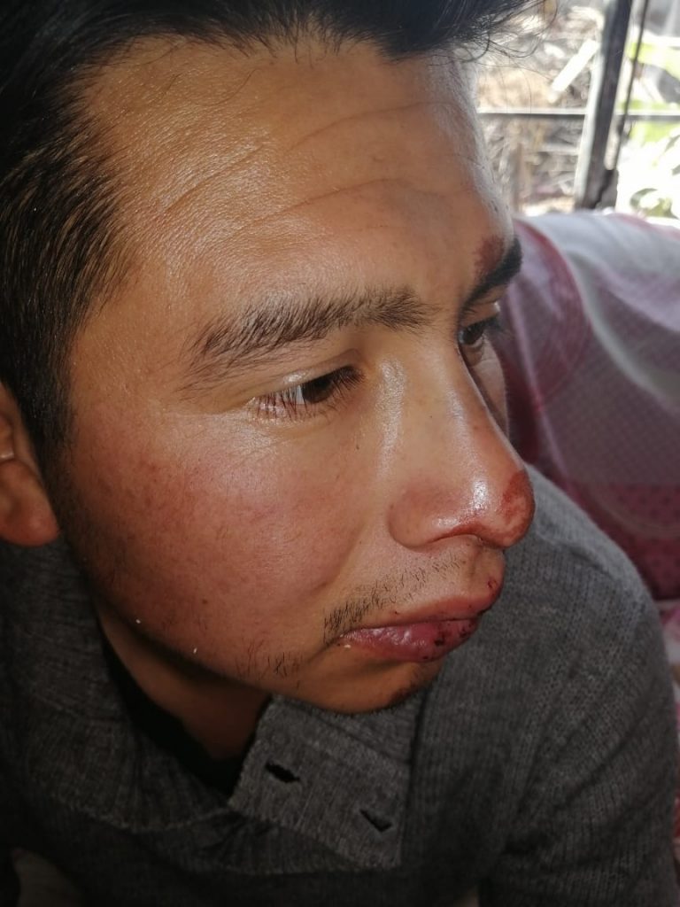 Policías Municipales de Amozoc propinan tremenda golpiza a joven