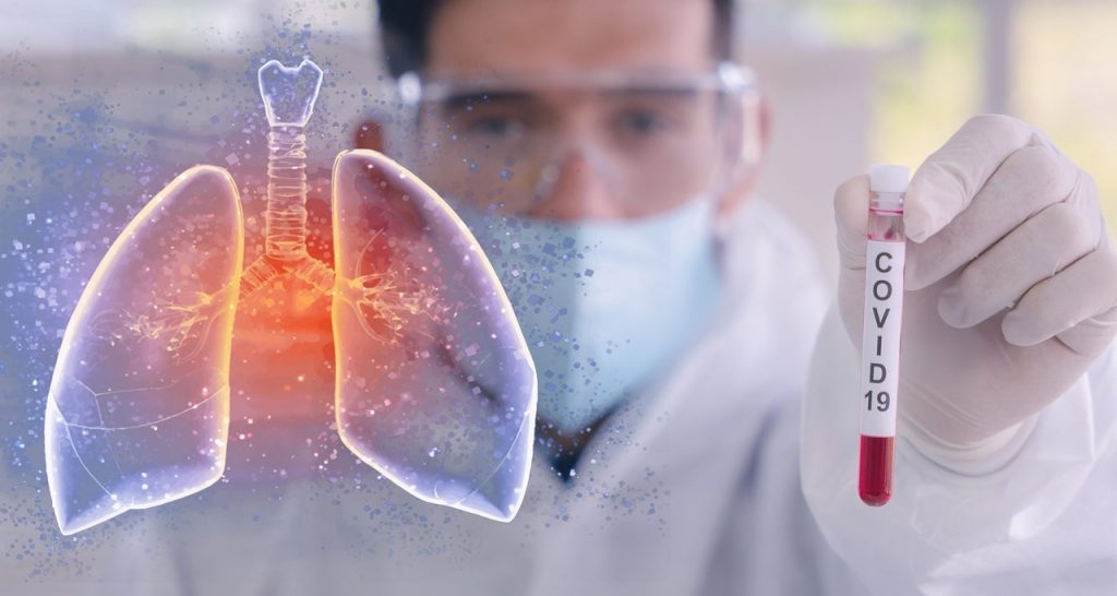 Hace 102 años, la gripe encerró a los poblanos en sus hogares