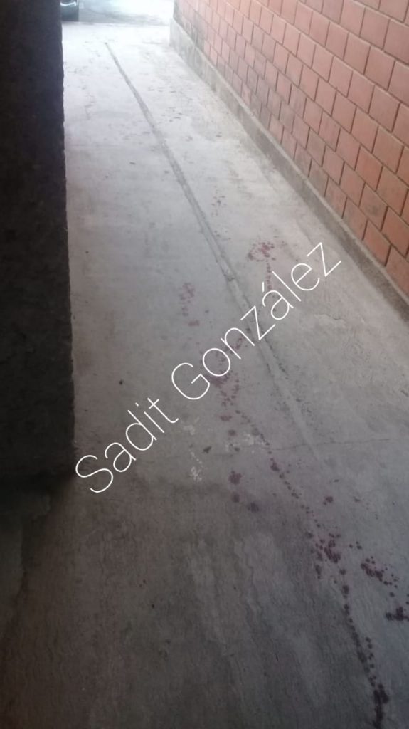 Riña en Amozoc deja 1 lesionado de arma de fuego