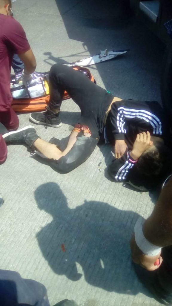 Atropellan a motociclista en la carretera federal a Tehuacán