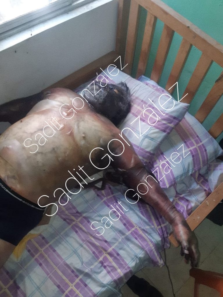 Hallan cuerpo putrefacto en Bosques de Santa Anita