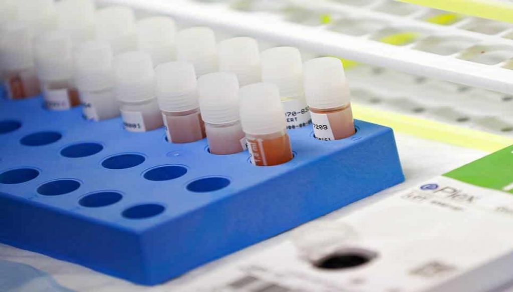 En Chihuahua reportan 815 casos de coronavirus y 144 decesos