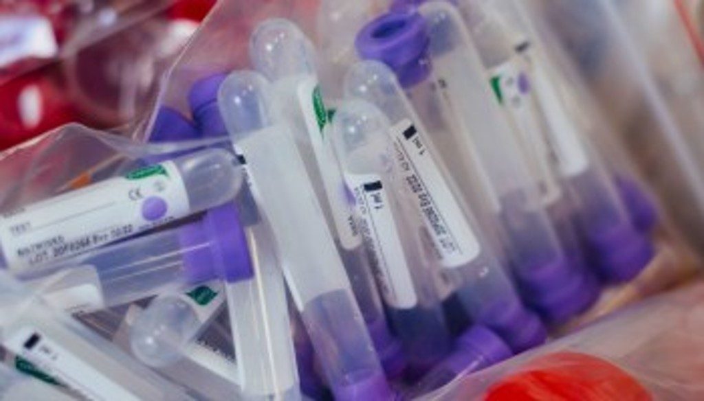 La OMS necesita $31.000 millones para pruebas y vacunas contra el coronavirus