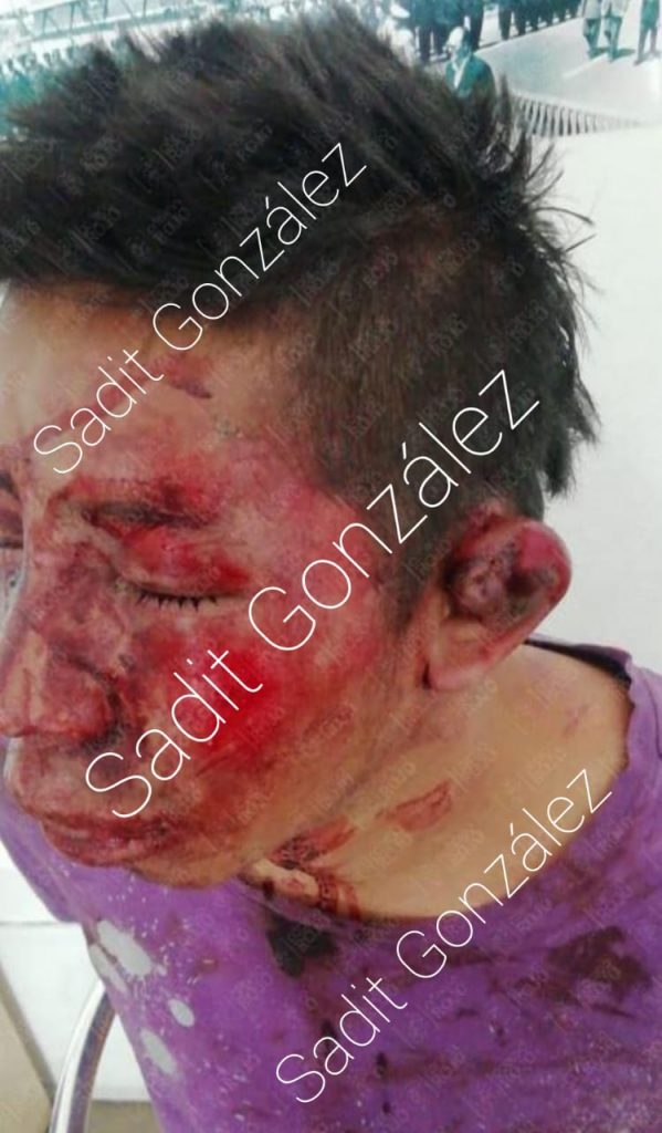 Pasajeros de la ruta Azteca detienen y golpean a ratero