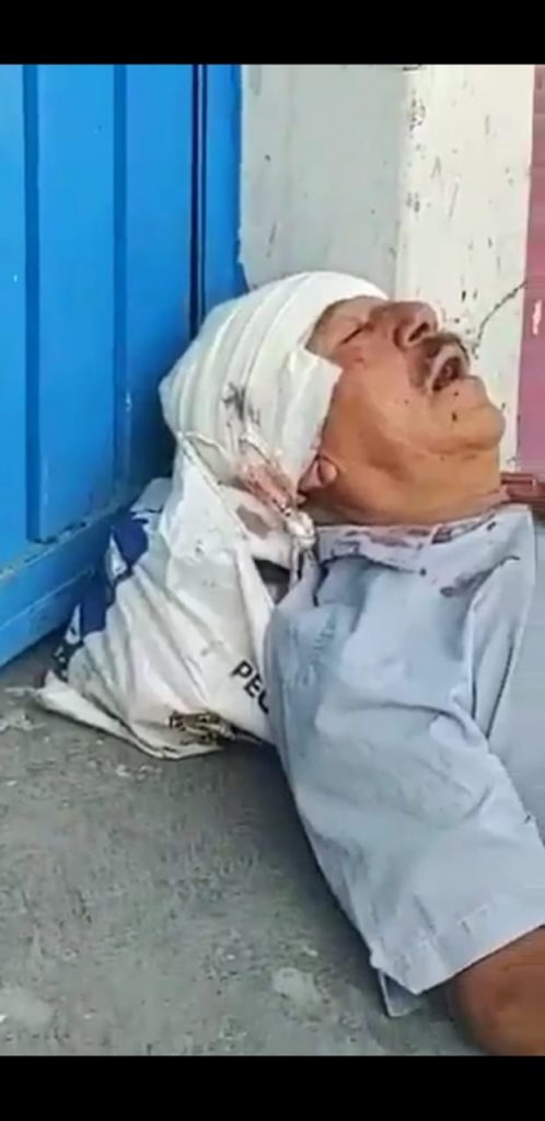 Video desde Puebla: En Tehuacán hieren de un balazo en la cabeza a un hombre de la tercera edad…y los paramédicos lo dejan tirado