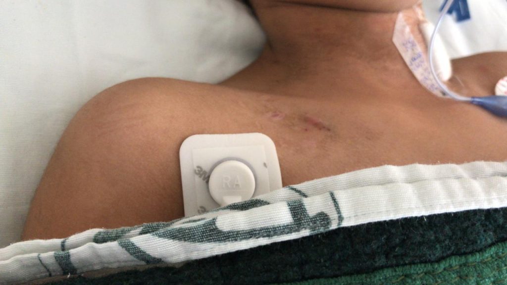 Grave una niña de 7 años en el Hospital de la Margarita, sus padres la maltrataban