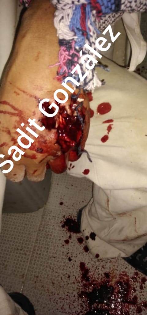 Sangriento asalto en panadería de San Pablo Xochimehuacán