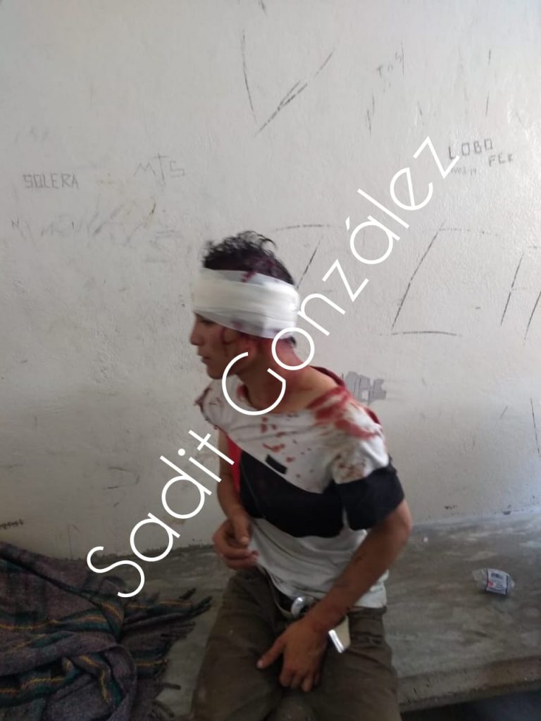 En acciones distintas detienen a dos presuntos ladrones en Amozoc