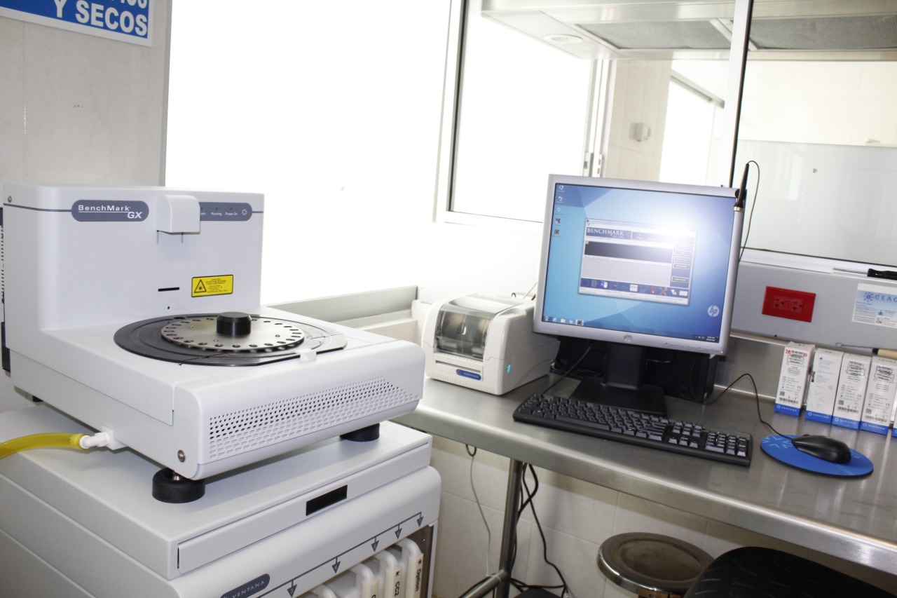 Moderniza ISSSTEP equipo de diagnóstico del área de patología