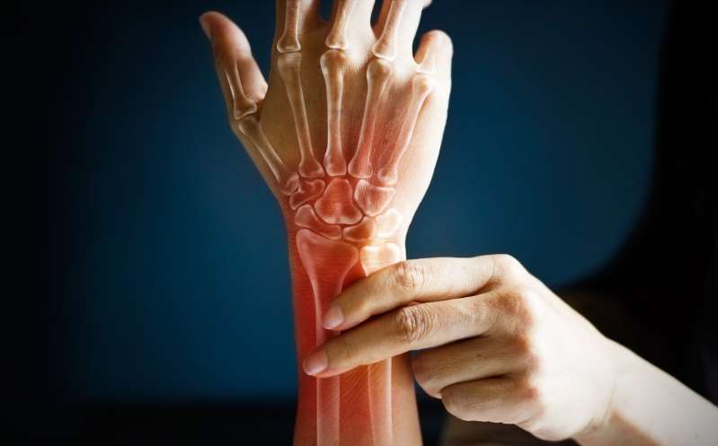 Día Mundial de la Artritis: qué es y por qué se celebra el 12 de octubre
