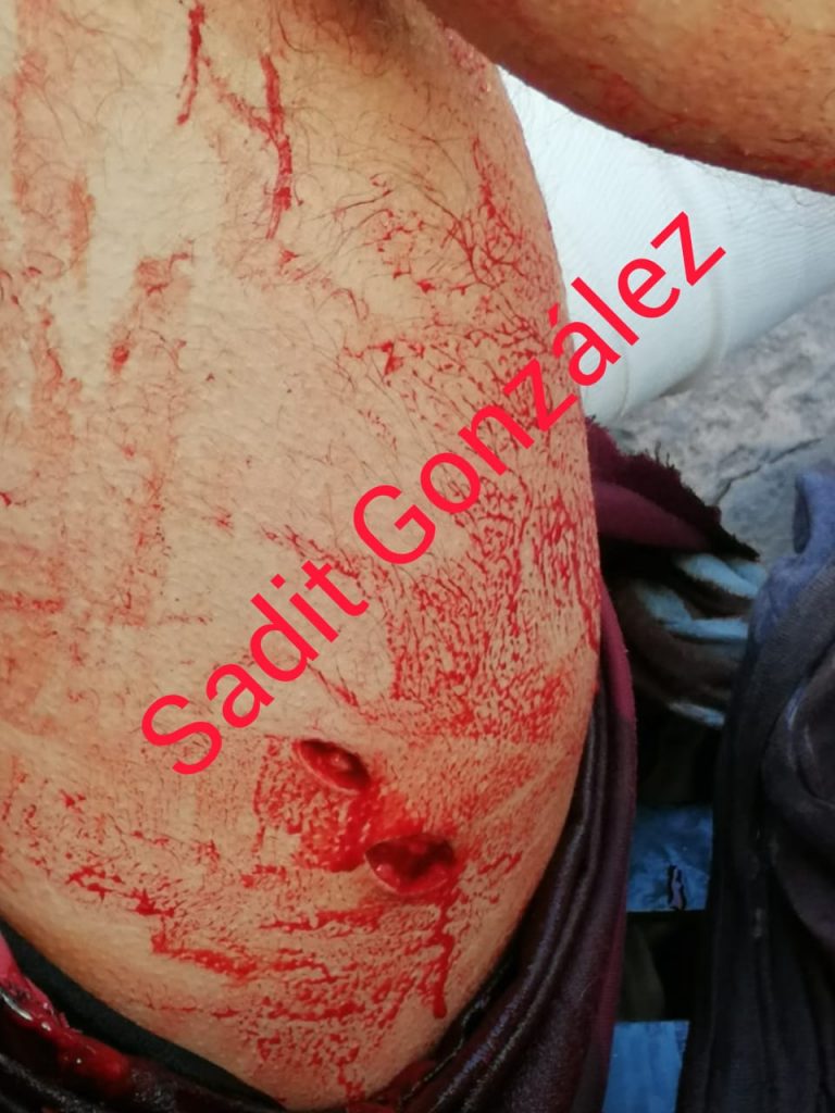 Por defender a su novia, apuñalan al Temerario en El Parián