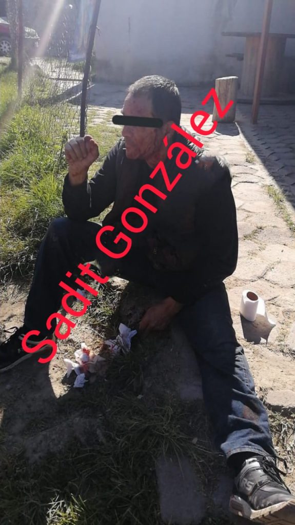 Asaltado y baleado hombre de 50 años