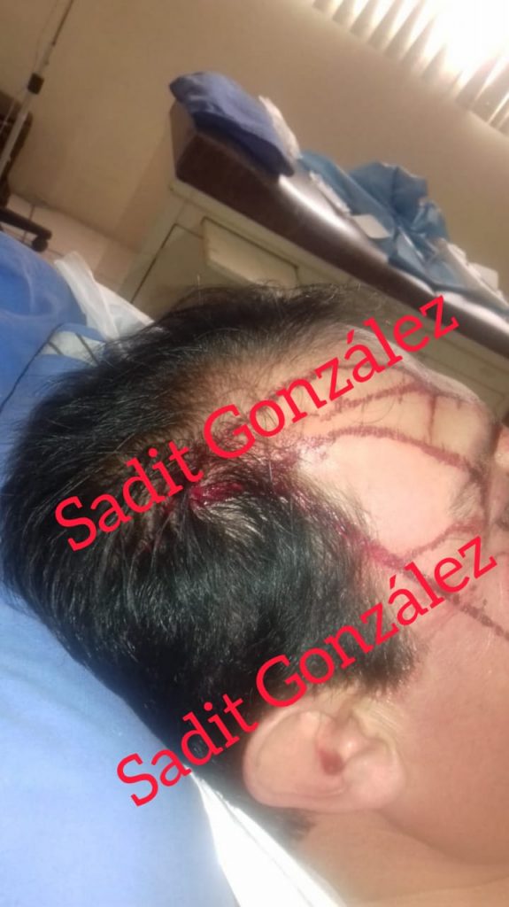 Le roban su camioneta y lo golpean en Chachapa, Amozoc