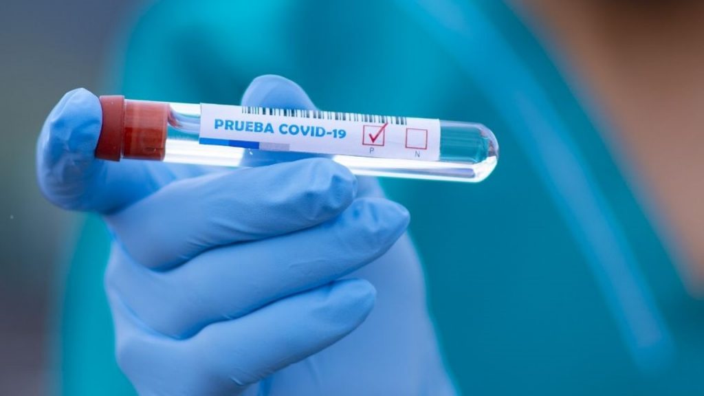 Brasil acumula 4,84 millones de casos de COVID-19