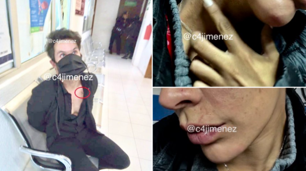 Filtran foto del actor Eleazar Gómez detenido tras intentar golpear a su novia