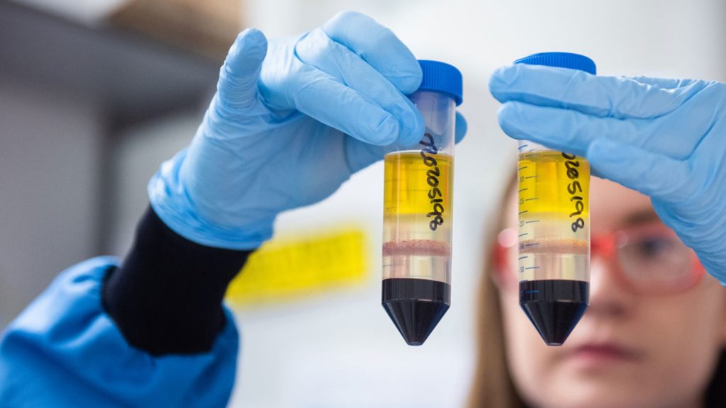 Hay una esperanza real de poner fin a la pandemia con los avances en las vacunas COVID-19, dice la OMS