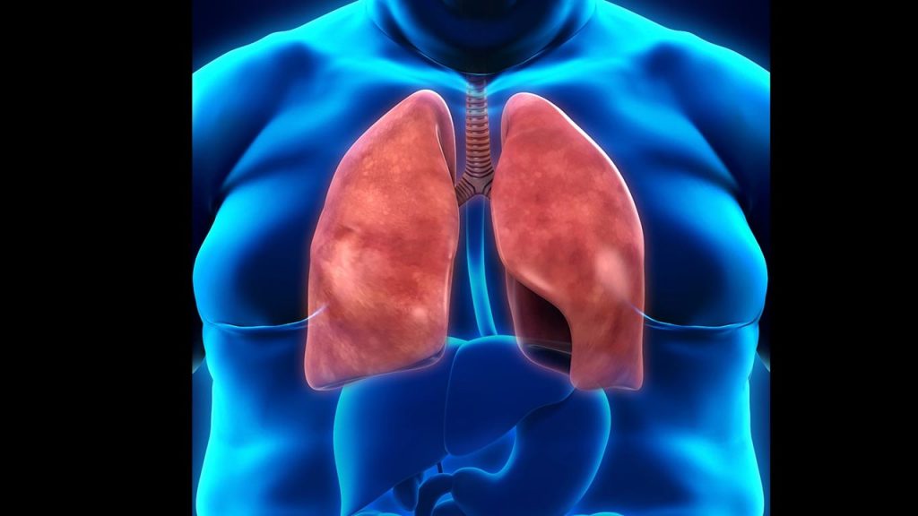 Asma y obesidad, una relación de mucho peso