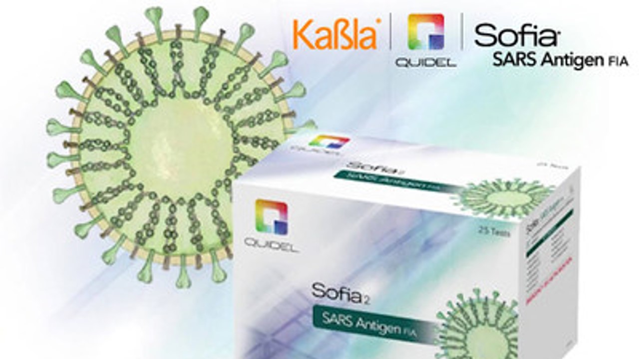 Primera prueba de antígeno de SARS-COV-2 estará pronto disponible en México