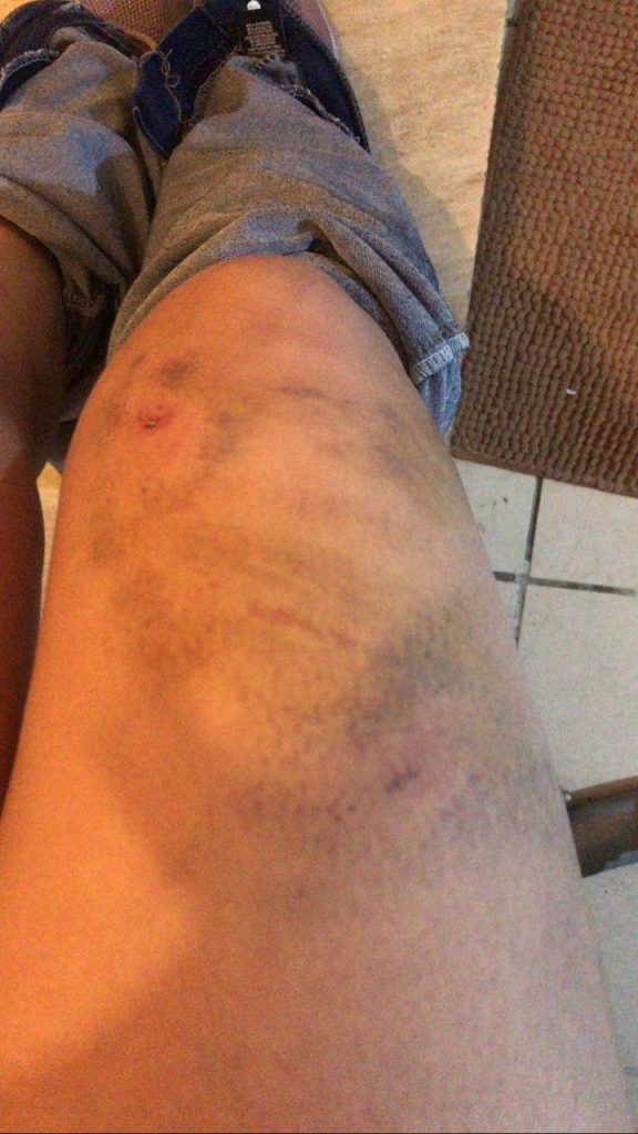 Se fue de casa para evitar los golpes que le daban en ella