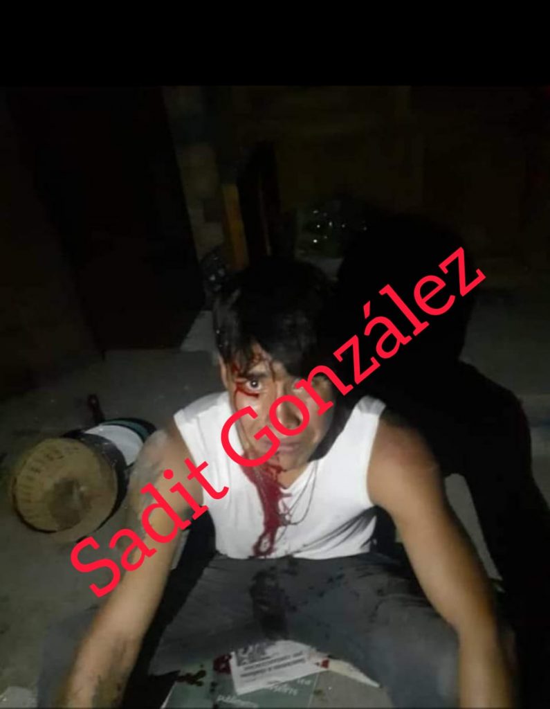 Taxistas detuvieron y golpearon a ratero