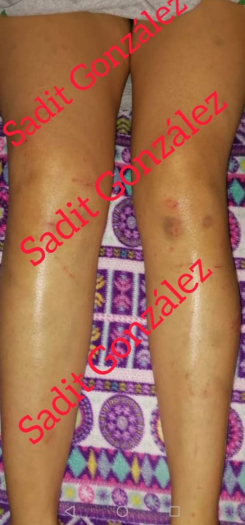 Denuncian intento de violación en la zona de bulevar Atlixco y Las Ánimas