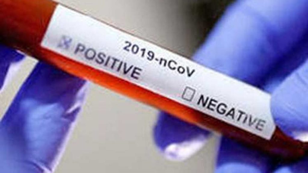 COVID-19: Brasil tiene 193,8 mil muertes y 7,61 millones de casos