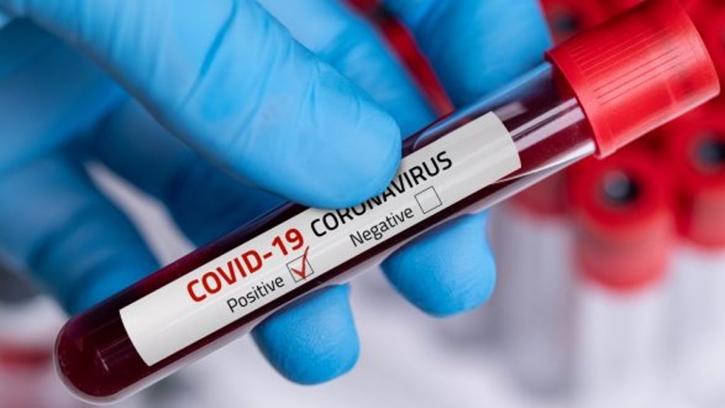 #ANÁLISIS El rebrote del COVID-19: magnitud y perspectivas