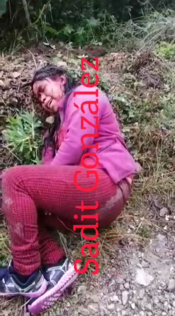 Una mujer fue agredida a machetazos supuestamente por su pareja en Chiconcuautla