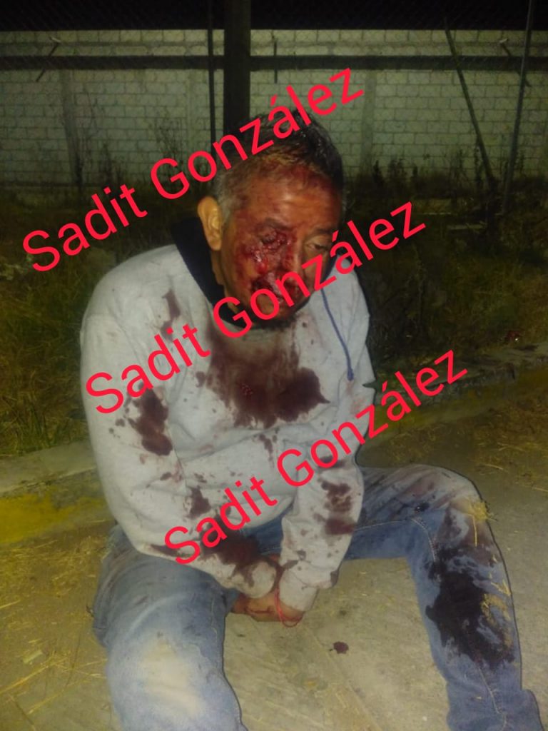 Cobarde taxista golpea y asalta a su pasajero en Amozoc