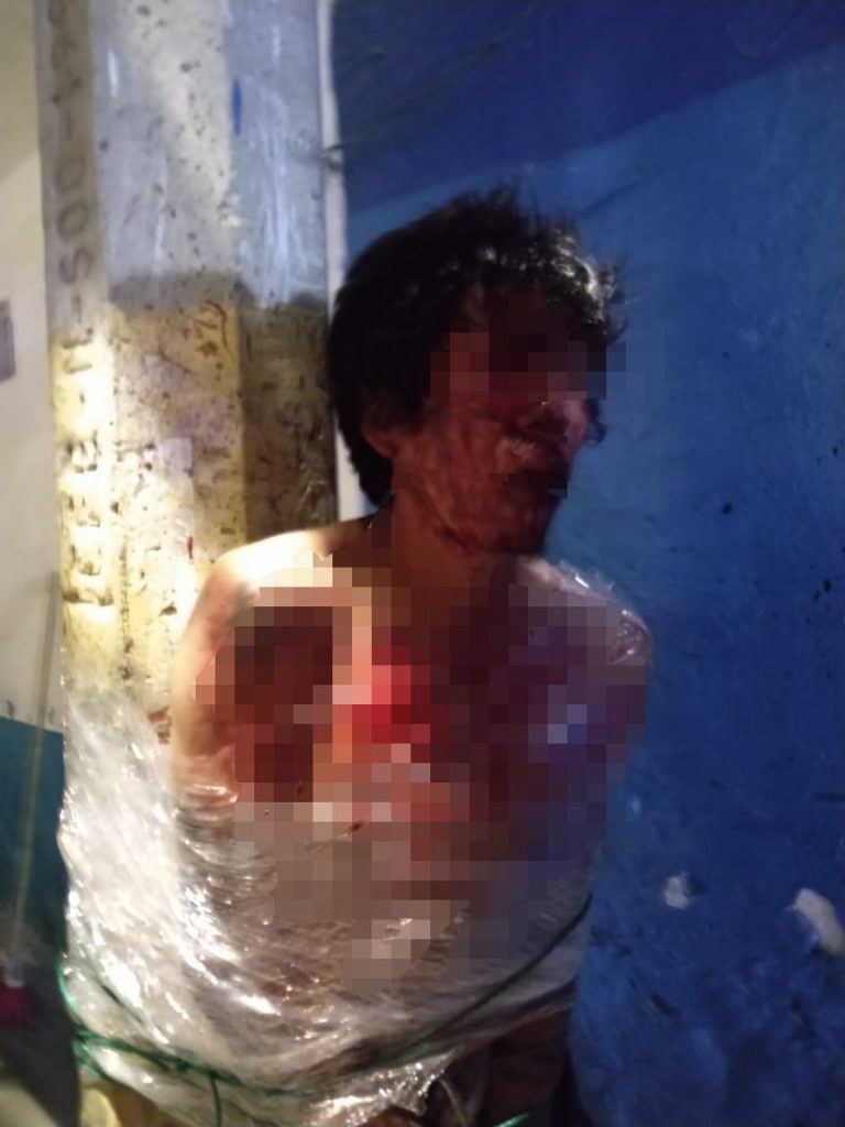 Vecinos de La Candelaria atrapan y golpean a supuesto ratero