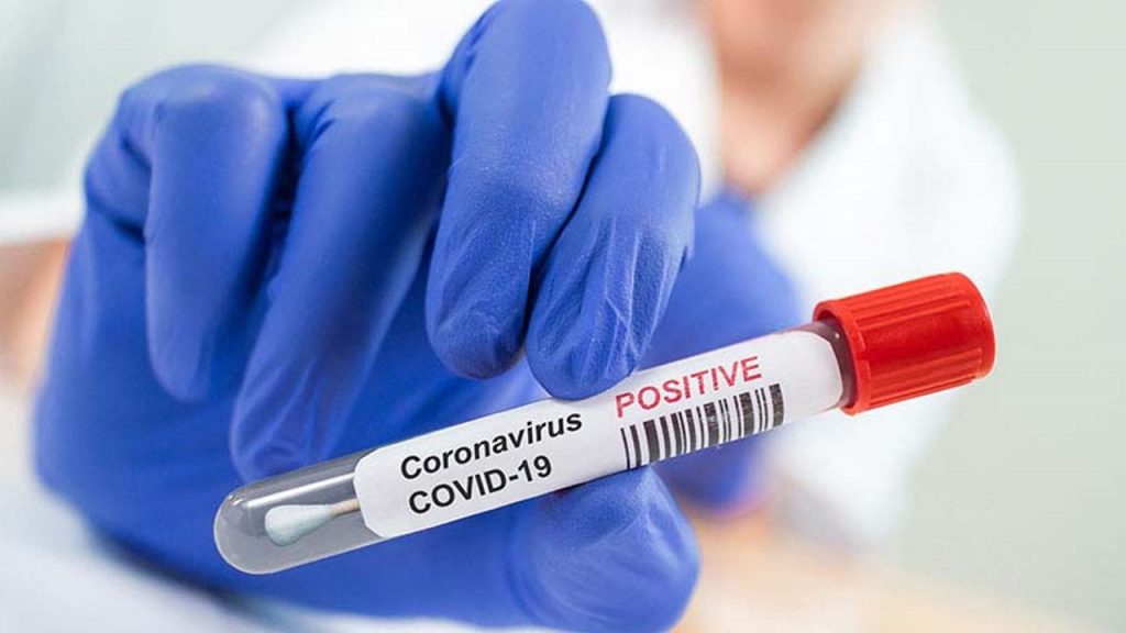 COVID-19: Brasil registra más de 54 mil nuevos casos y 1.351 muertes