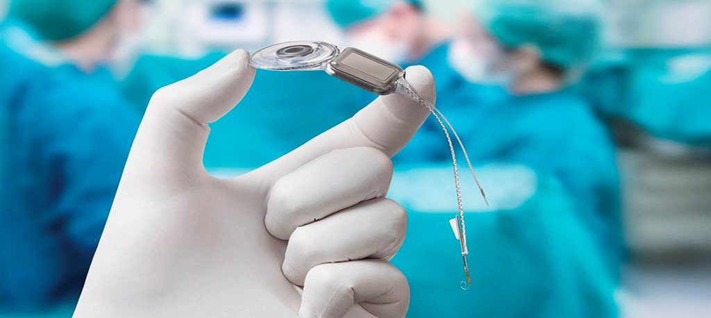 A 33 años del primer implante coclear colocado en México