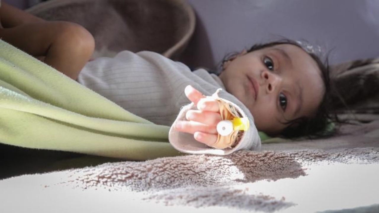 Las Naciones Unidas advierten de que la desnutrición aguda amenaza a la mitad de los niños menores de cinco años en el Yemen en 2021