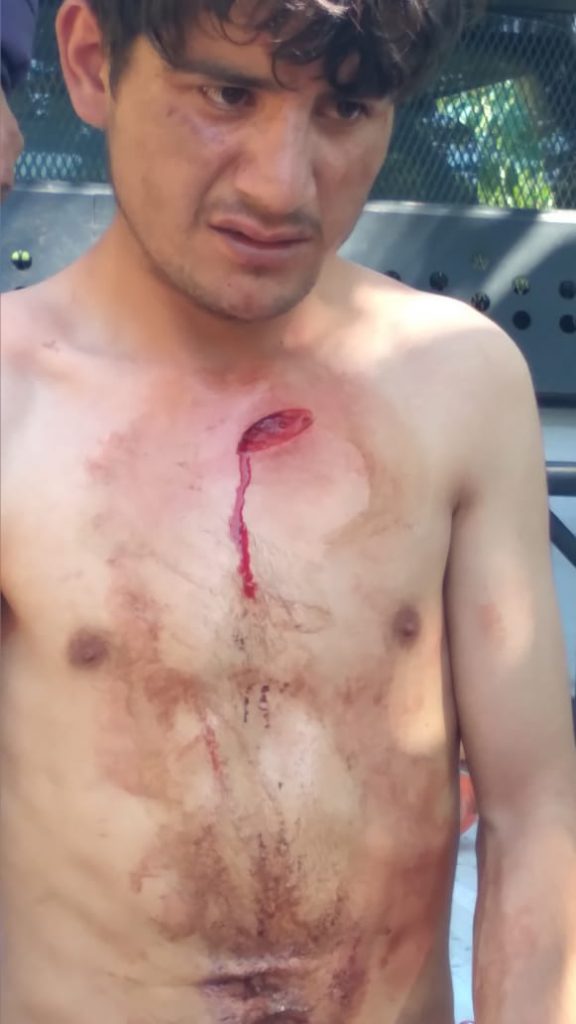 Desde Huauchinango: Joven discapacitado fue atacado por un familiar que intentó violar a su mamá