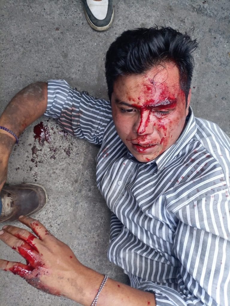 Desde Huauchinango: Locatarios del mercado 5 de Mayo detuvieron a ladrón-sicario