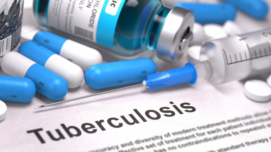 La COVID-19 frena el progreso para eliminar la tuberculosis en América