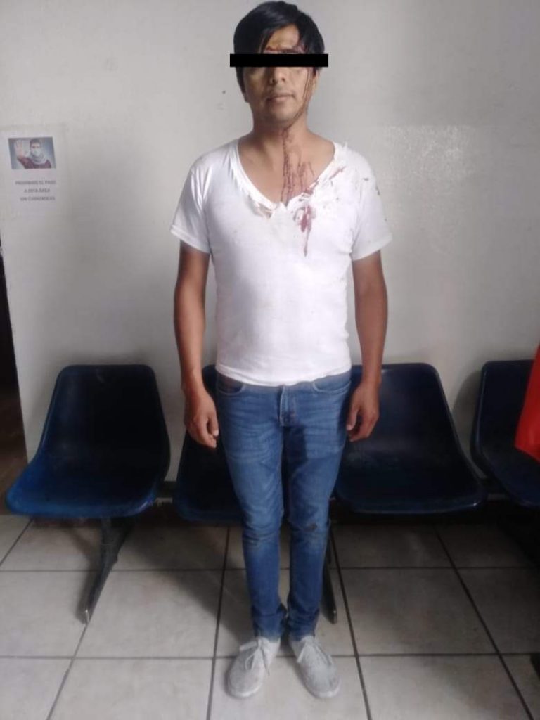 Pelea de exnovios se convirtió en reyerta entre familias de Texmelucan