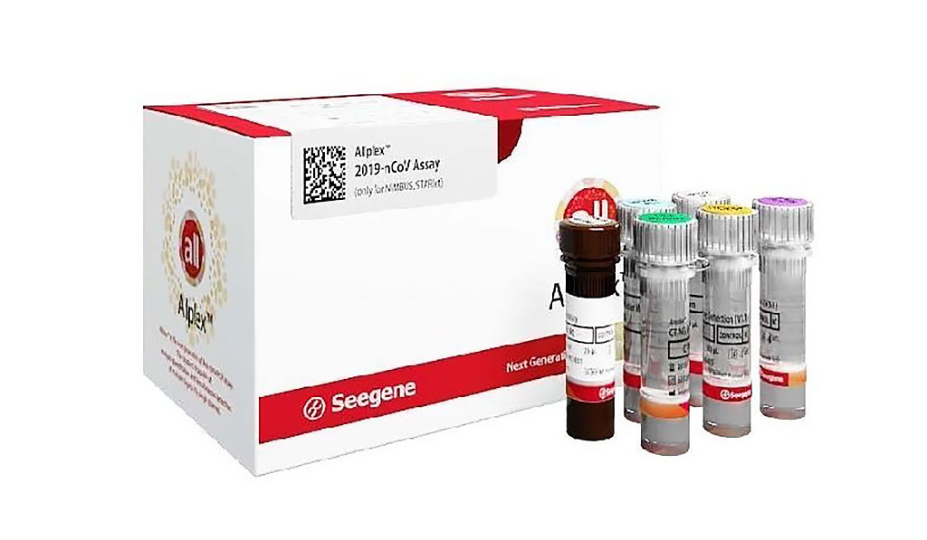 Seegene comienza a exportar sus nuevas pruebas de variantes de la COVID-19 en todo el mundo para ayudar a contener la propagación de la pandemia