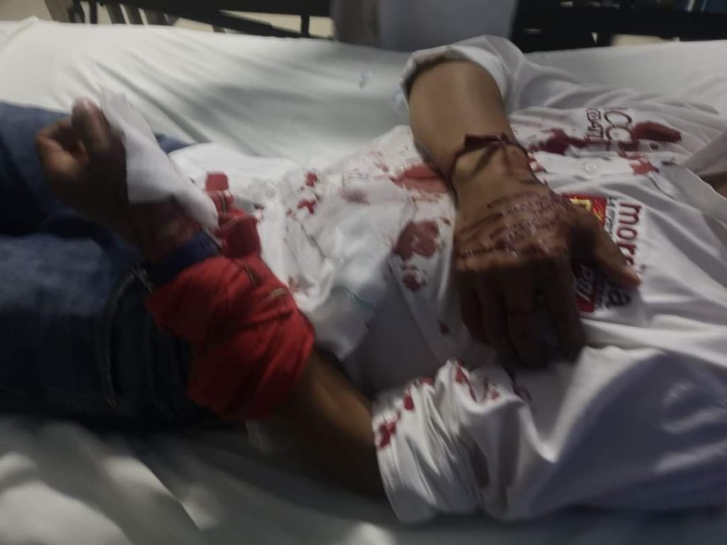 Balean a candidato de Morena en Santa Clara Ocoyucan