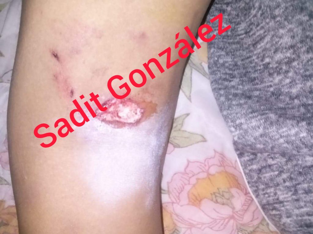 Vecinos de Álamos Vista Hermosa denuncian un perro agresivo