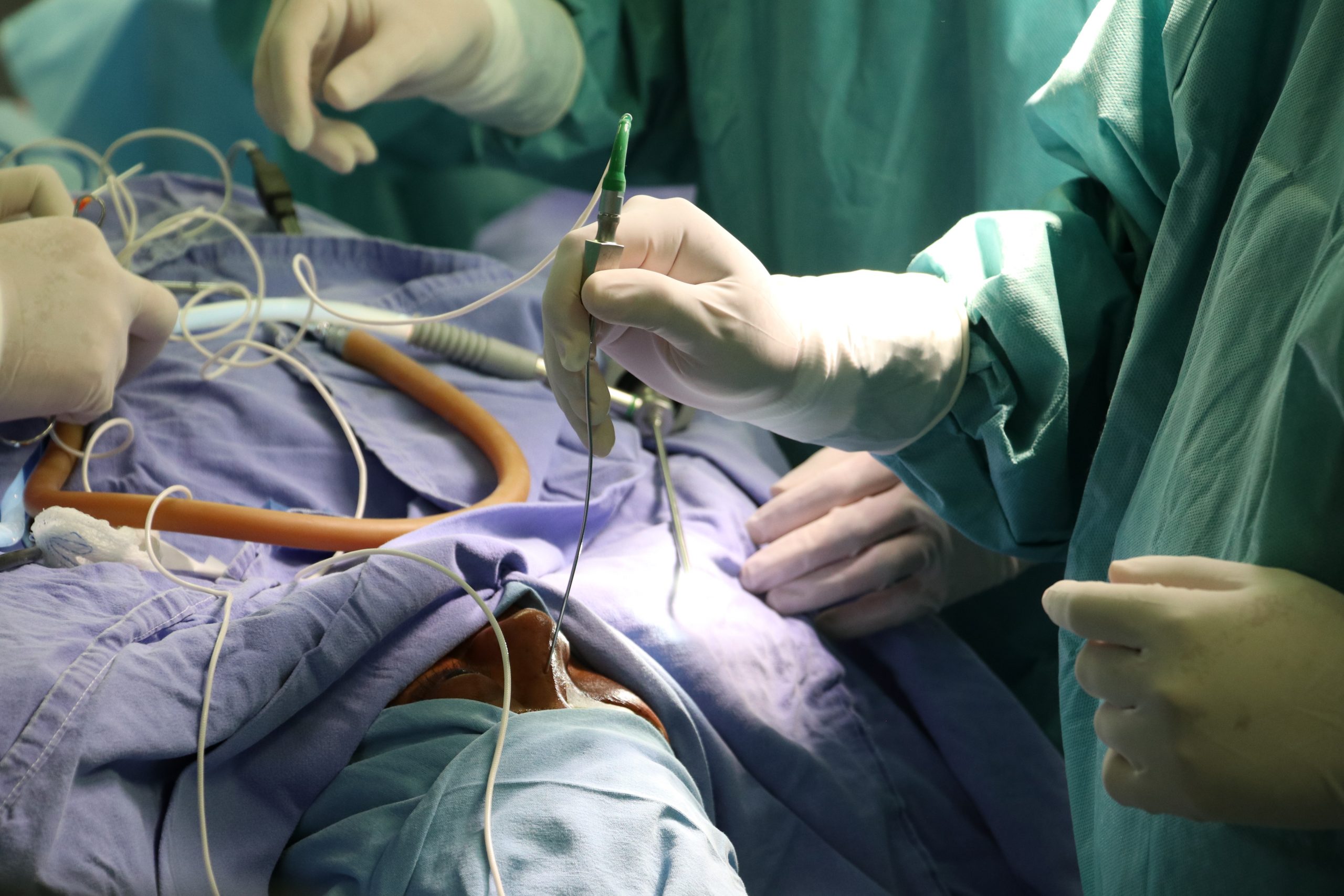 Realiza ISSSTEP exitosas cirugías multidisciplinarias de Alta Especialidad