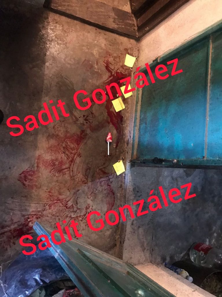 Delante de su familia y en pleno día, lo balean en Atzitzintla