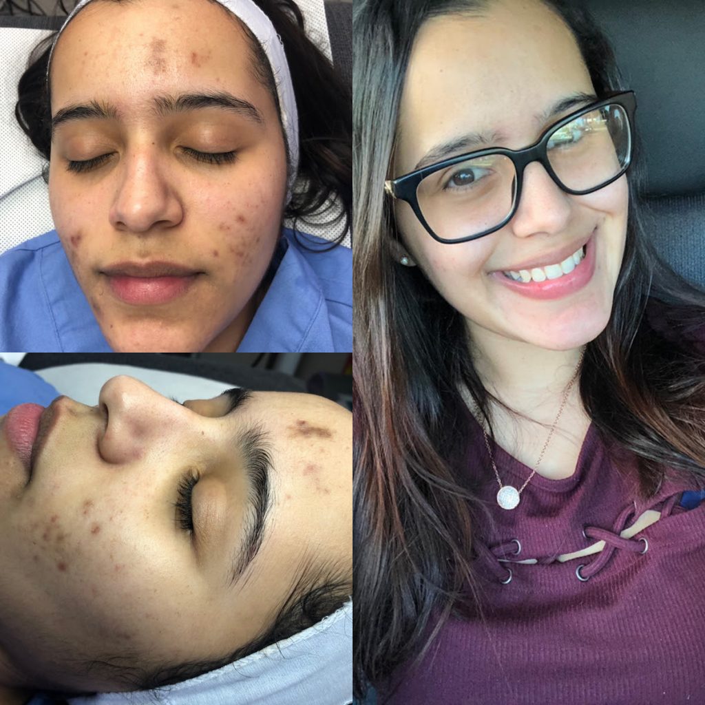 ¿Por qué aparecen manchas en la piel y cómo eliminarlas?