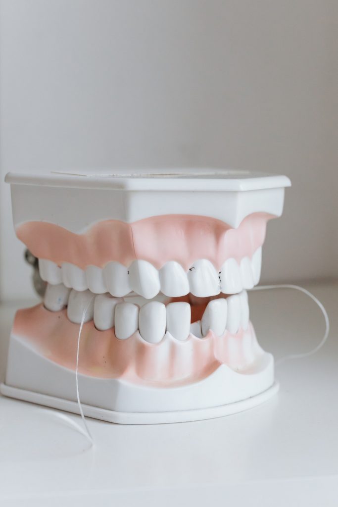 ¡Que no te pase! Secuelas de un mal diagnóstico de alineación dental