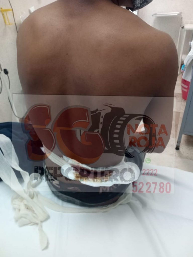 Joven fue herido con arma blanca tras una riña en Cuetzalan