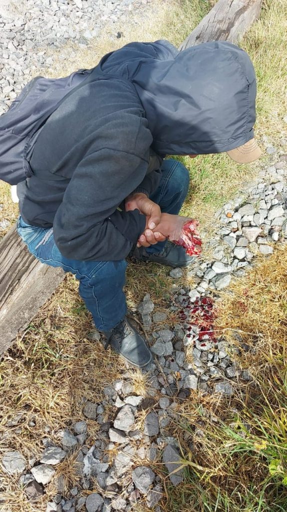 “La Bestia” le arranca la mano a migrante en Apizaco, Tlaxcala