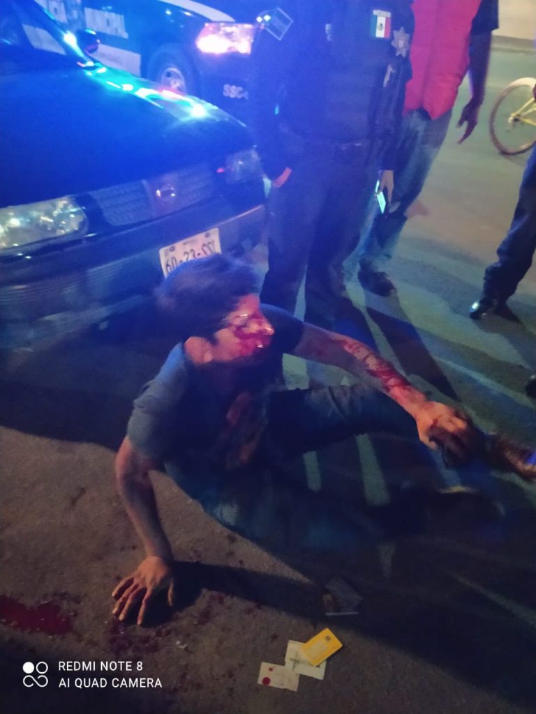 Detienen y golpean a presunto asaltante en Totimehuacán